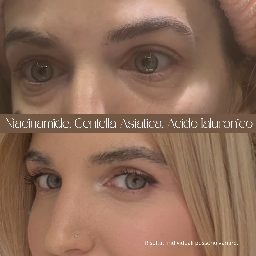 Siero Contorno Occhi - LIFT SUPREME